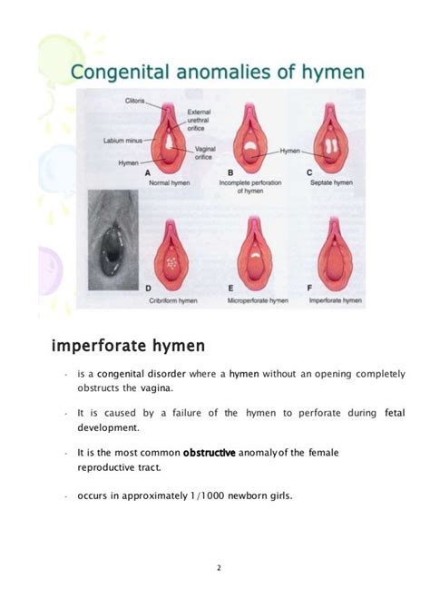 imperforate hymen|Imperforate hymen